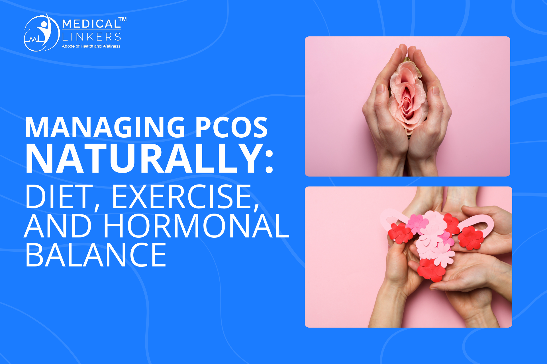 Managing PCOS Naturally: Diet, Exercise & Hormonal Balance