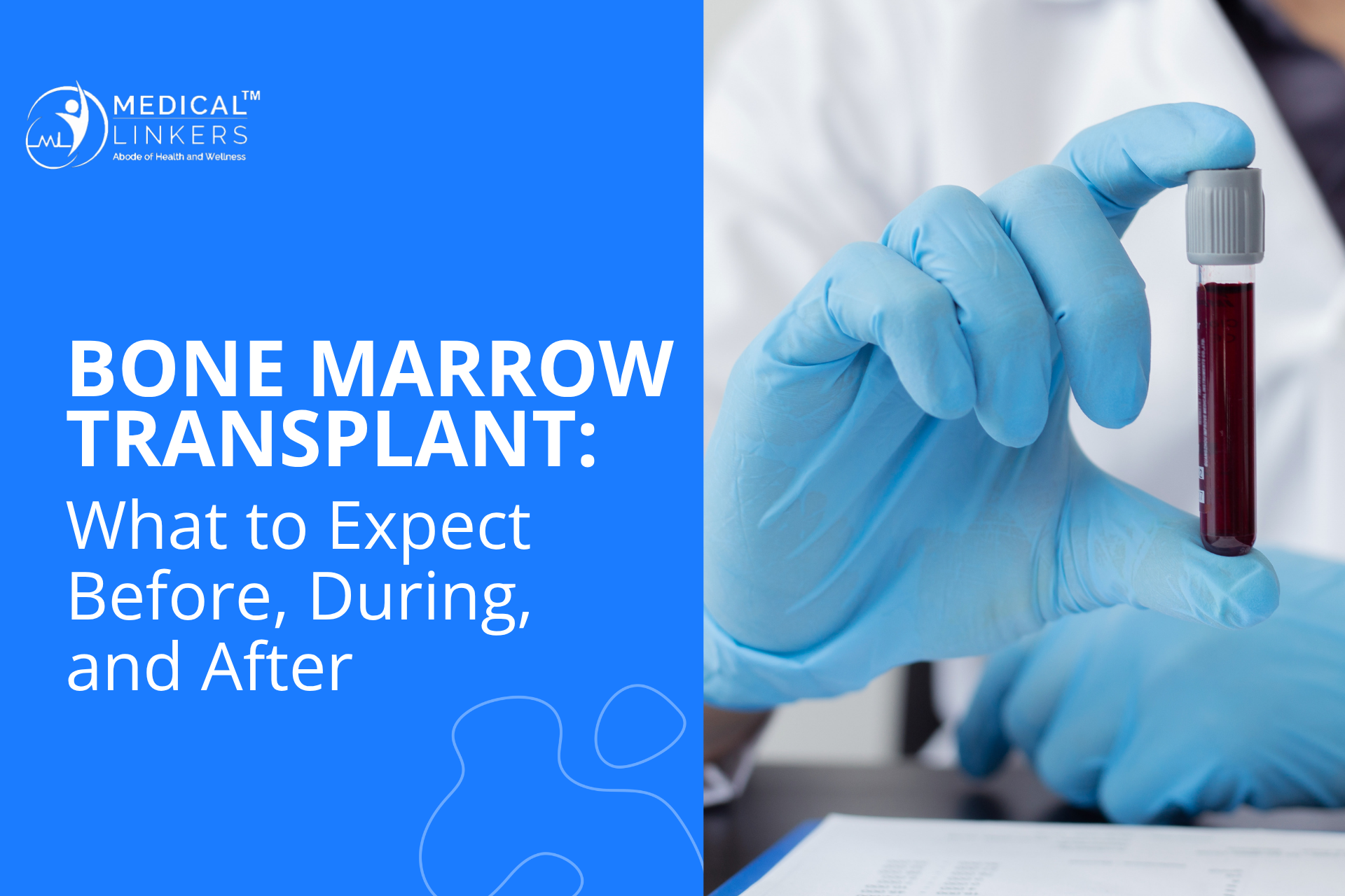 Bone Marrow Transplant: What to Expect Before, During, and After